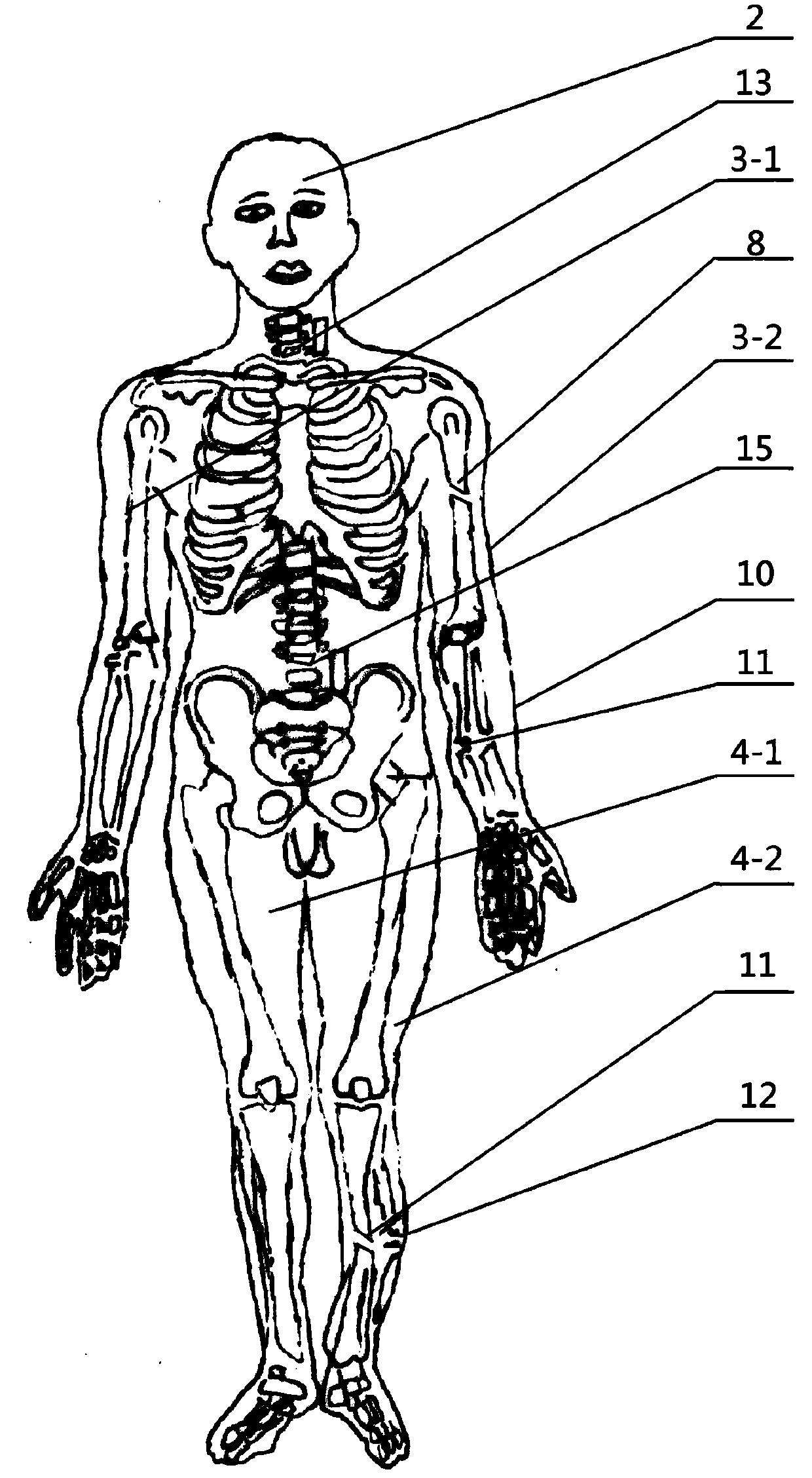 Standard patient for examination on spinal and limb fracture emergency fixation and carrying training