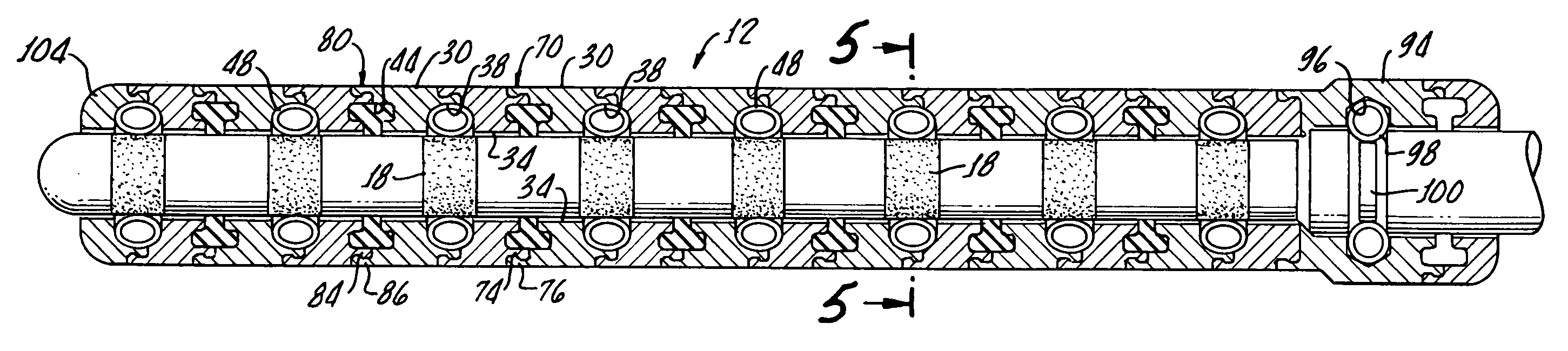 Stackable assembly for direct connection between a pulse generator and a human body