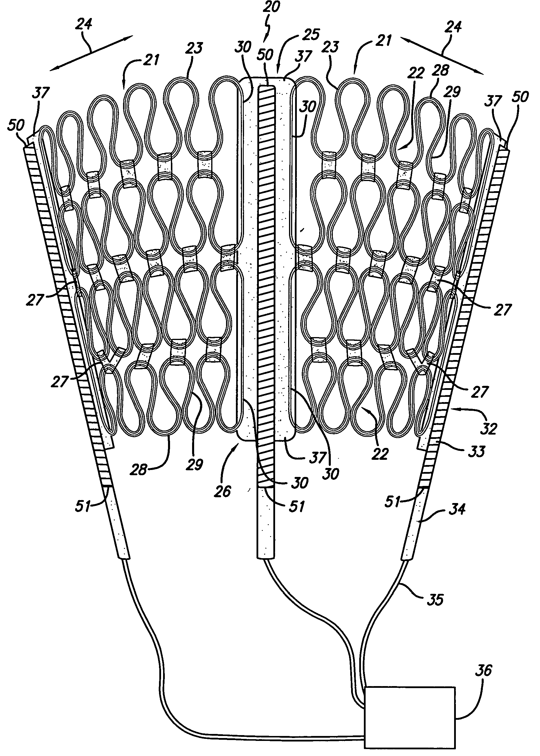 Cardiac harness for treating congestive heart failure and for defibrillating and/or pacing/sensing