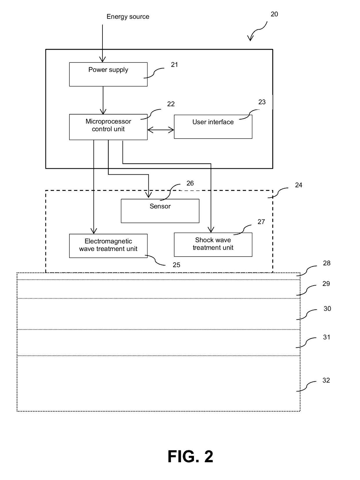 Methods and devices for tissue treatment using shock waves and electromagnetic field