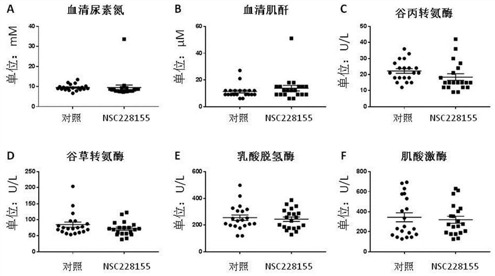 Use of nsc228155 in the preparation of medicines for preventing and treating acute kidney injury