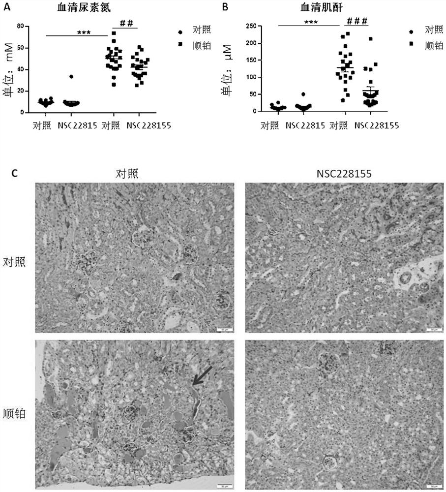 Use of nsc228155 in the preparation of medicines for preventing and treating acute kidney injury