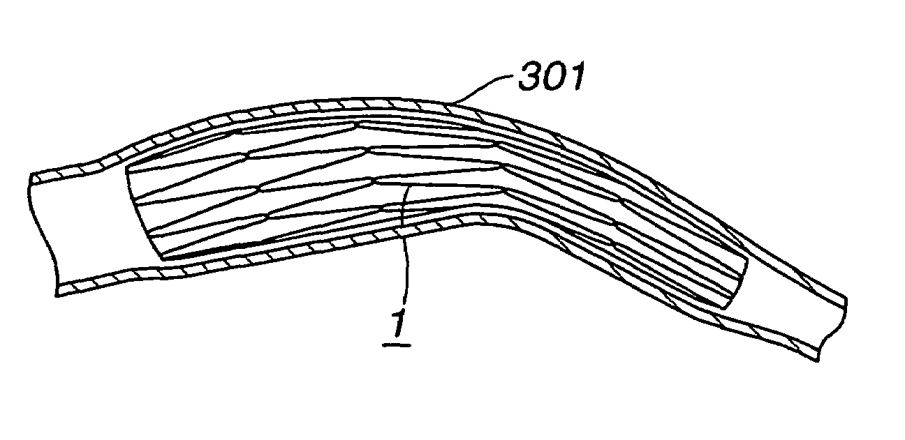 Stent for vessel