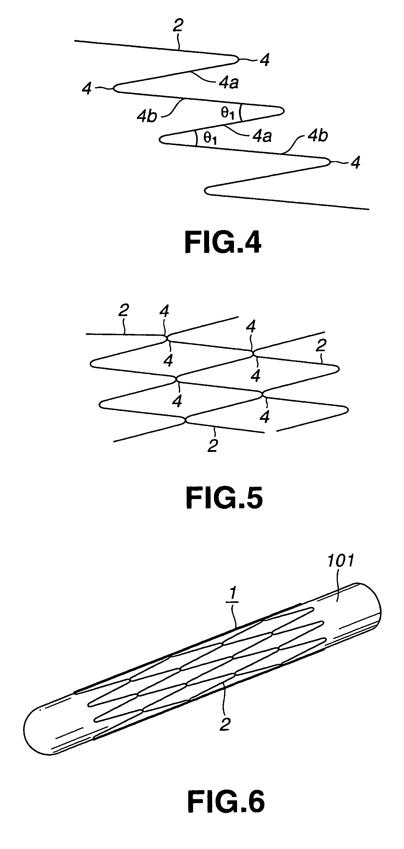 Stent for vessel