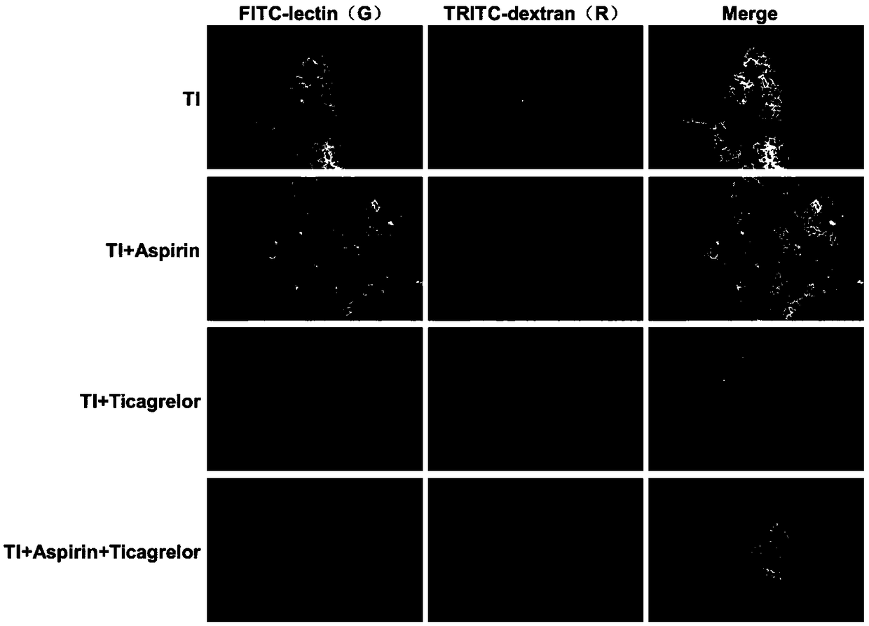 Application of aspirin in preventing or treating colon cancer