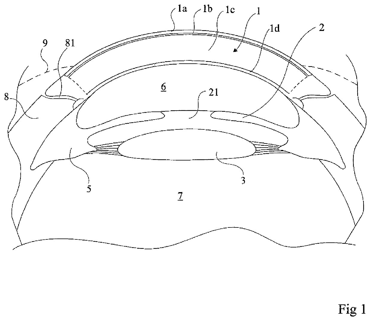 System for measuring intraocular pressure