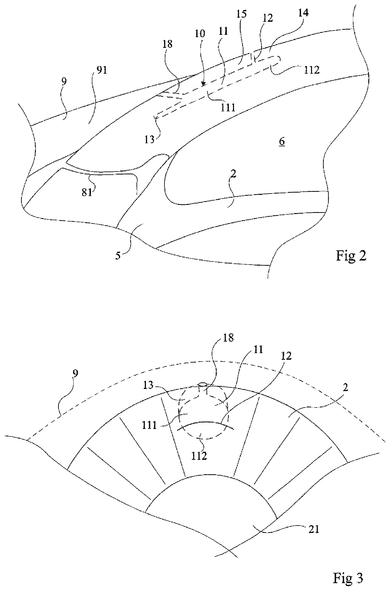 System for measuring intraocular pressure