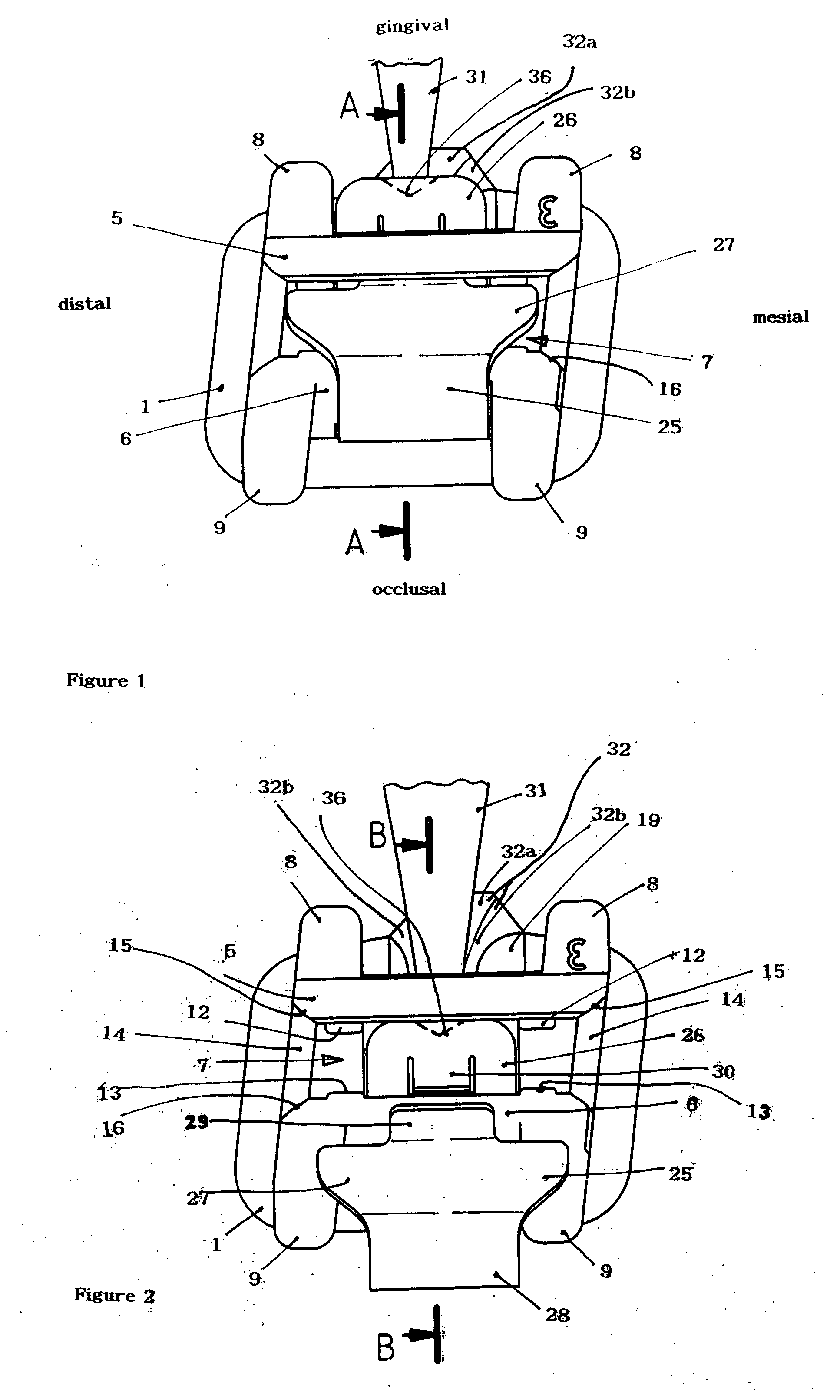 Self-ligating bracket for use in orthodontics