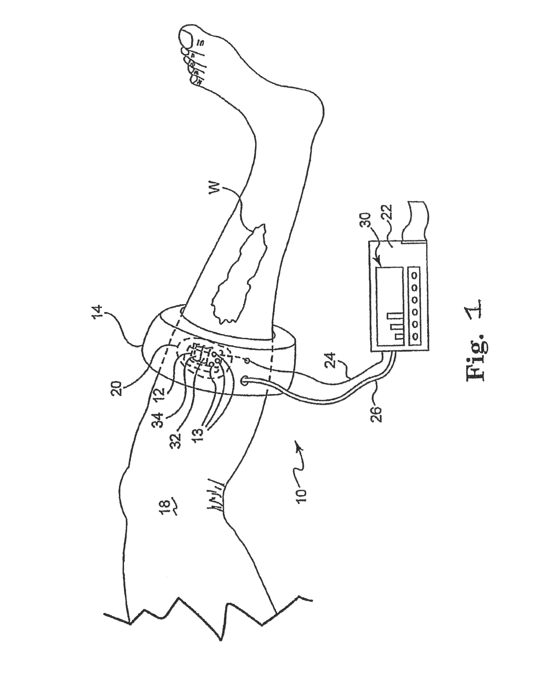 Method and system for assessing severity and stage of peripheral arterial disease and lower extremity wounds using angiosome mapping
