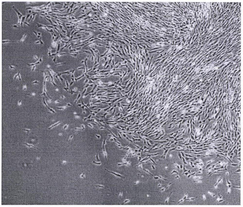 Preparation method of SARS-CoV-2 gene silencing immortalized lung stem cells