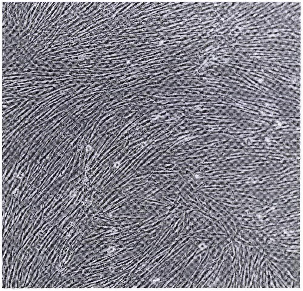 Preparation method of SARS-CoV-2 gene silencing immortalized lung stem cells