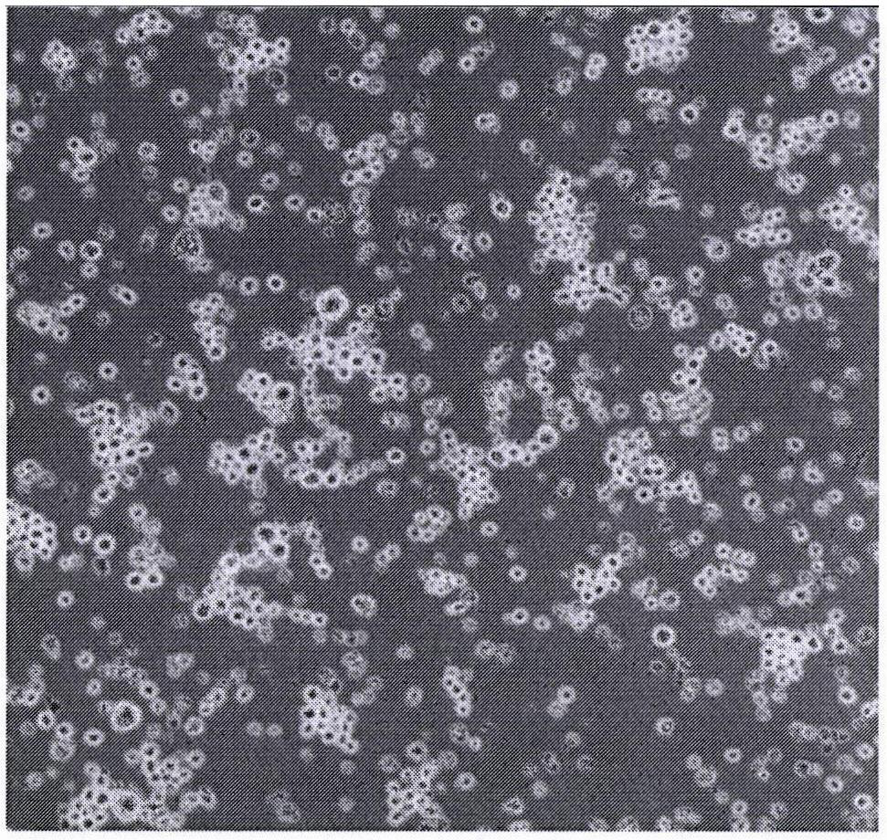 Preparation method of SARS-CoV-2 gene silencing immortalized lung stem cells