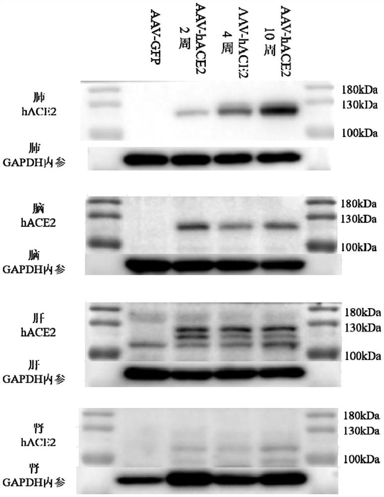 Animal model for expressing human ACE2 and application of animal model