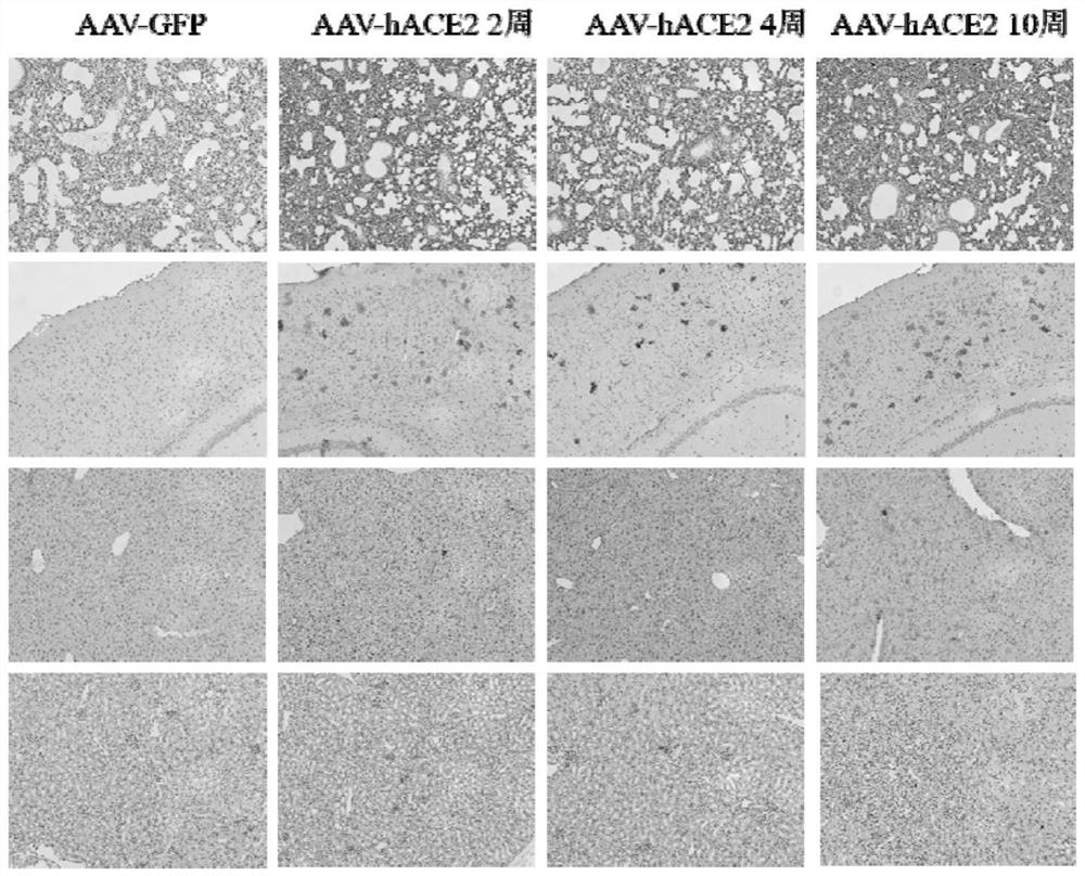 Animal model for expressing human ACE2 and application of animal model