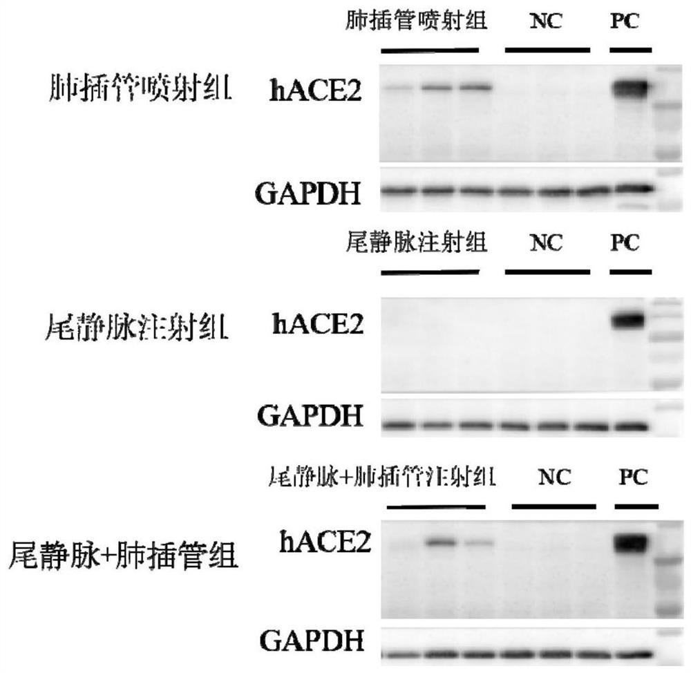 Animal model for expressing human ACE2 and application of animal model