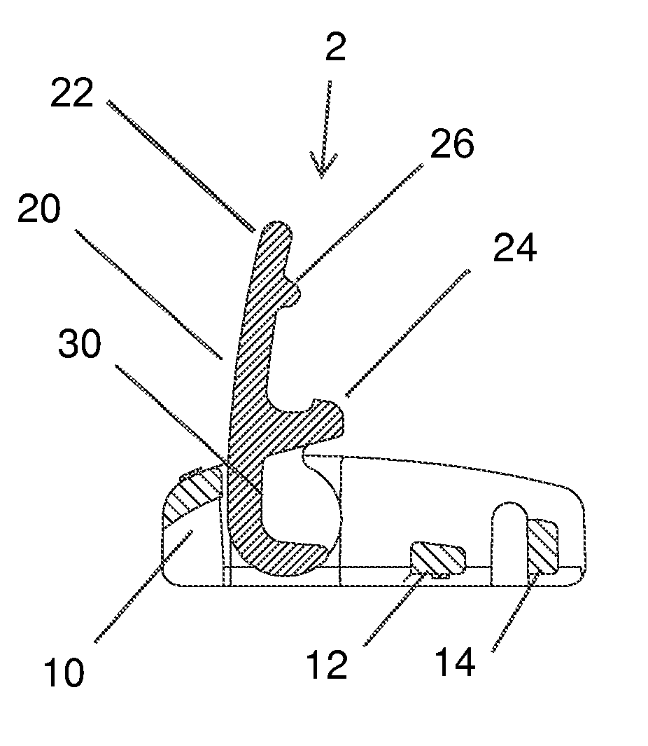 Lace locking system