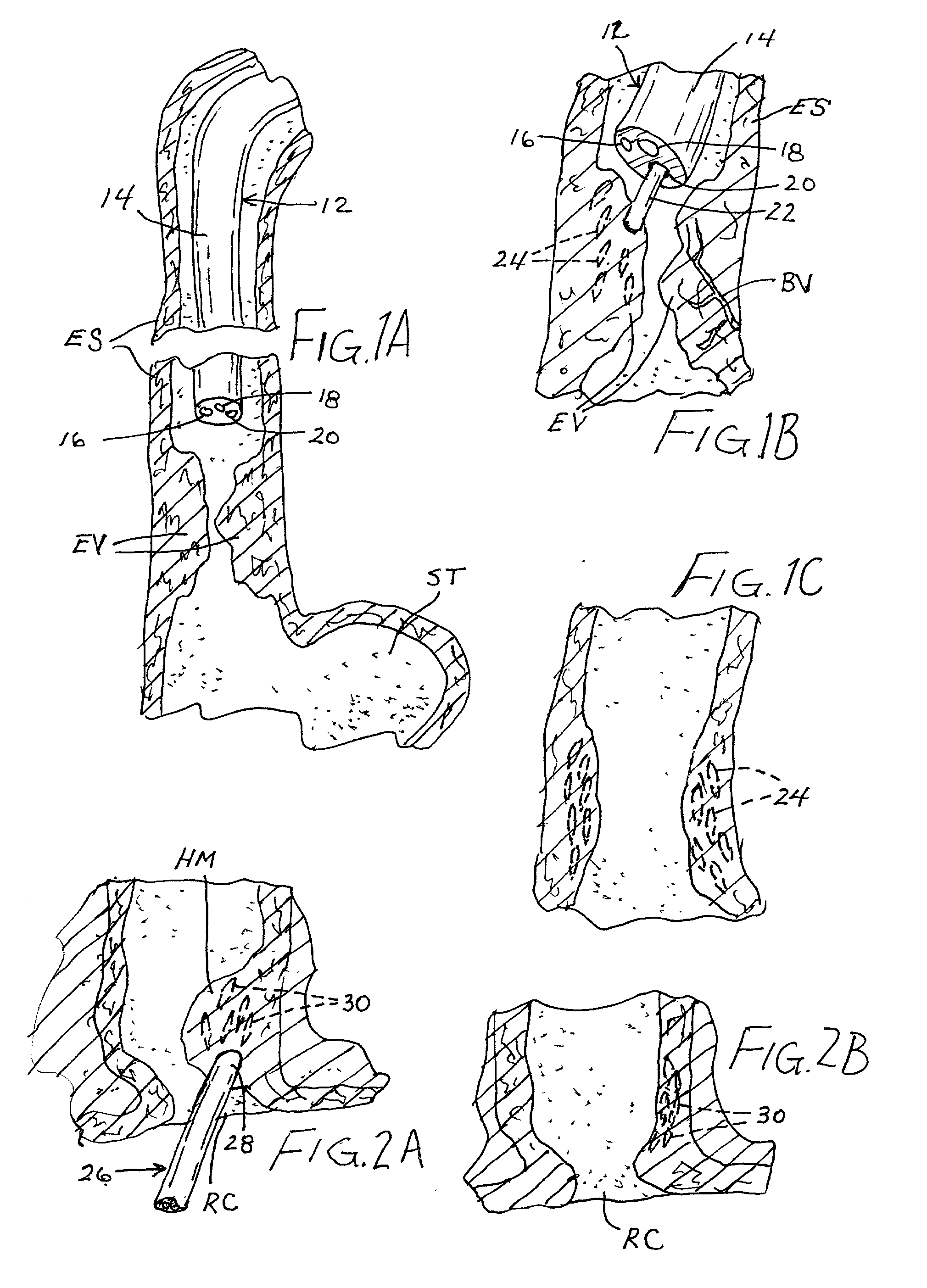 Medical treatment method and device utilizing magnetic particles