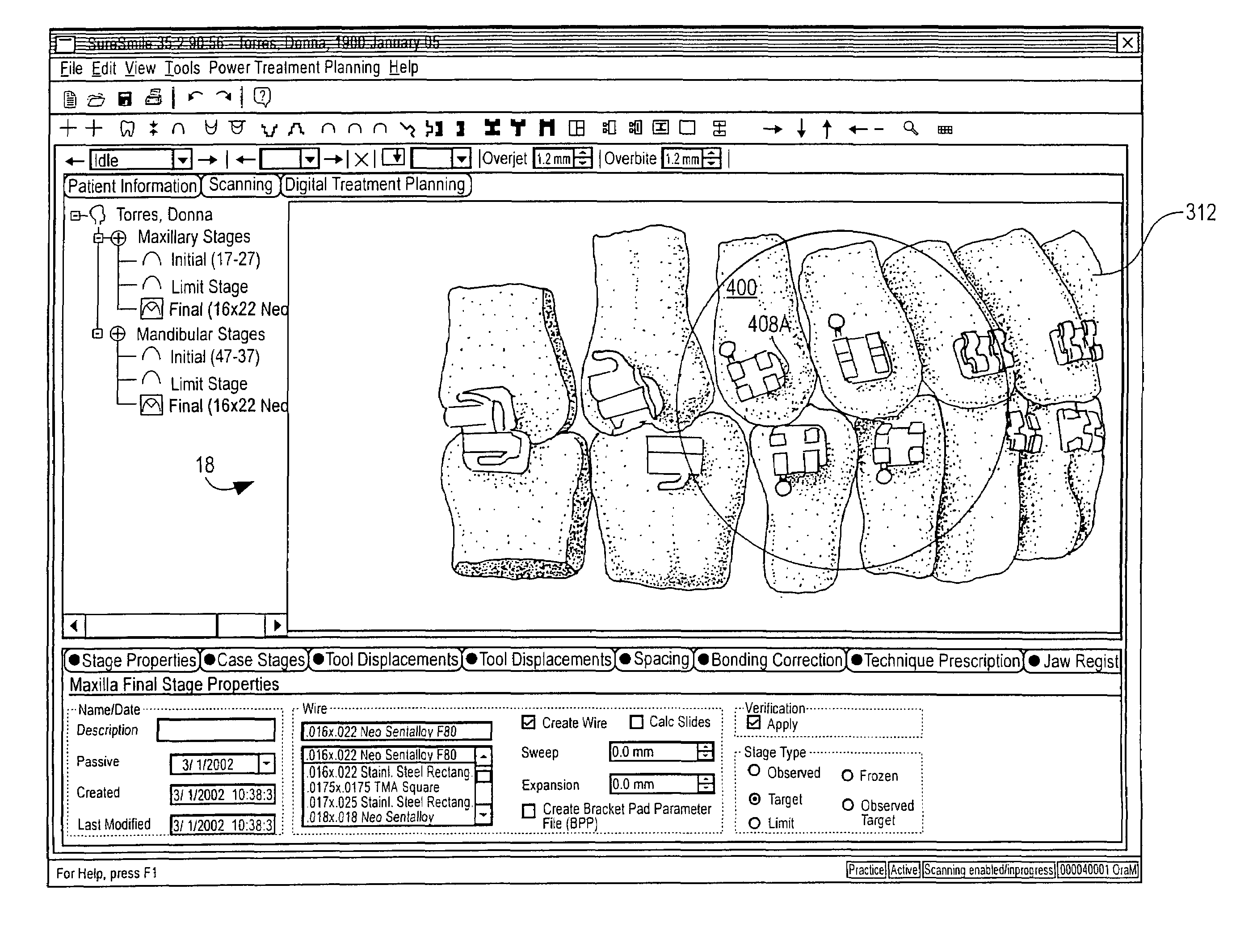 Virtual bracket library and uses thereof in orthodontic treatment planning