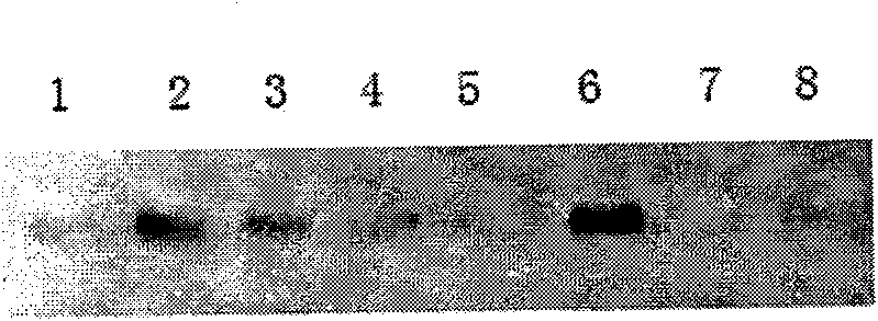 Application of cumarins compound in preparing medicine for inhibiting tumor growth