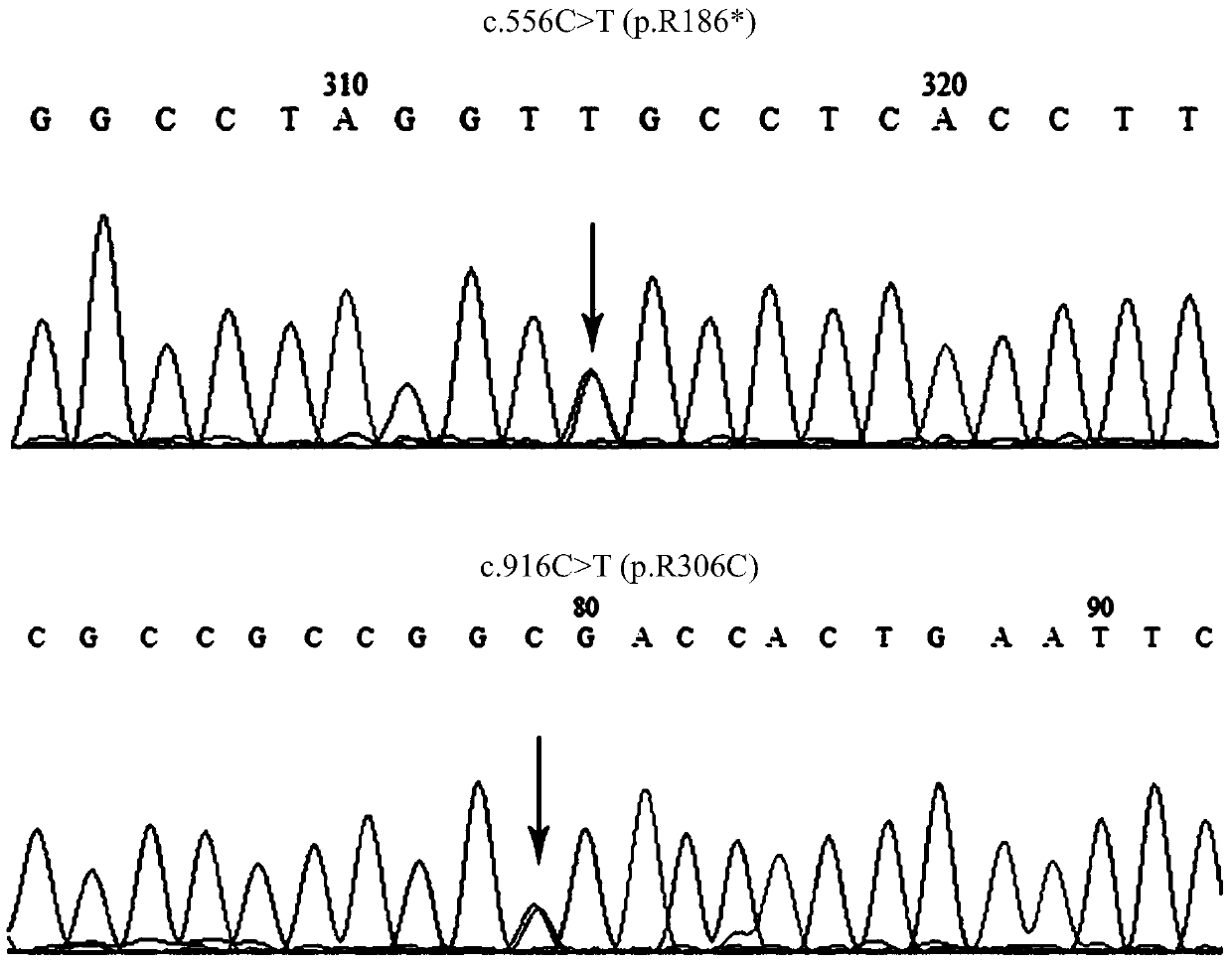 bcs1l gene mutant and its application