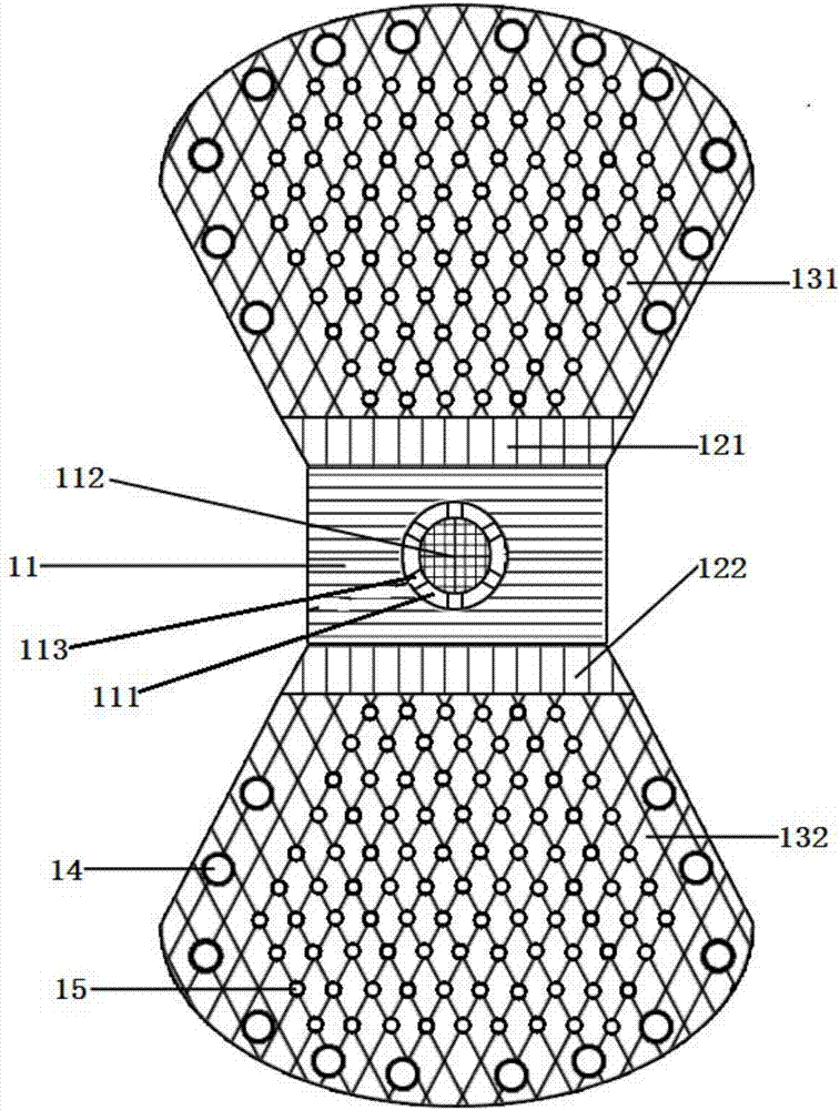 Protection structure of alveolar bone defect bone grafting region