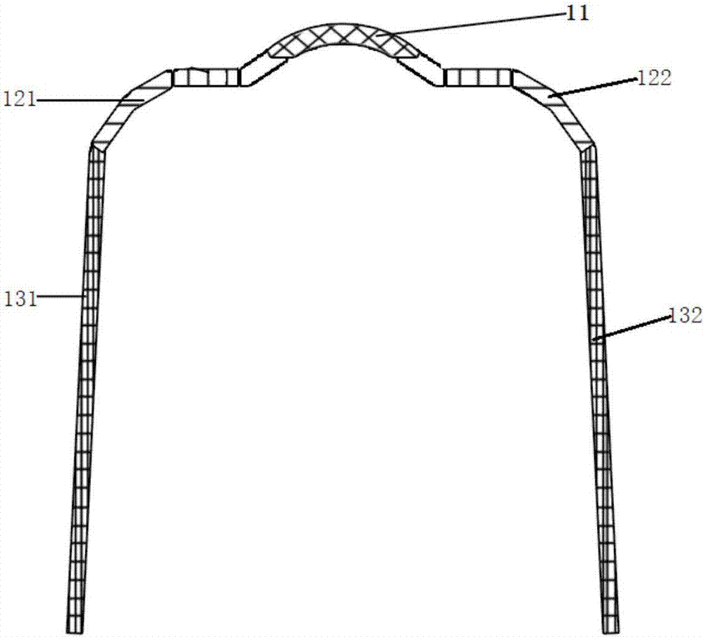 Protection structure of alveolar bone defect bone grafting region