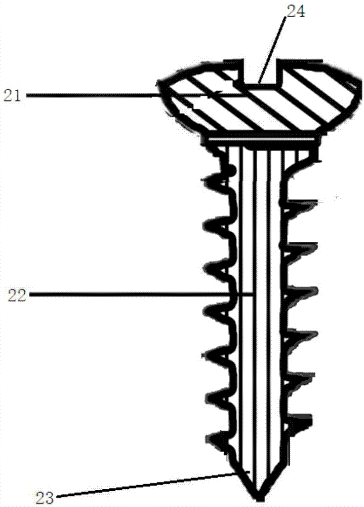 Protection structure of alveolar bone defect bone grafting region