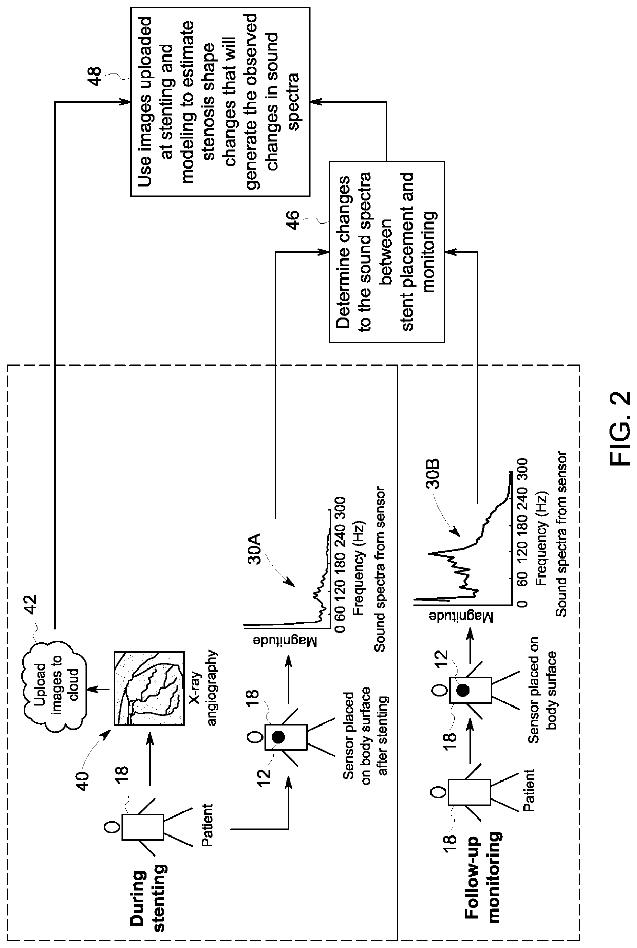 Vascular assessment using acoustic sensing