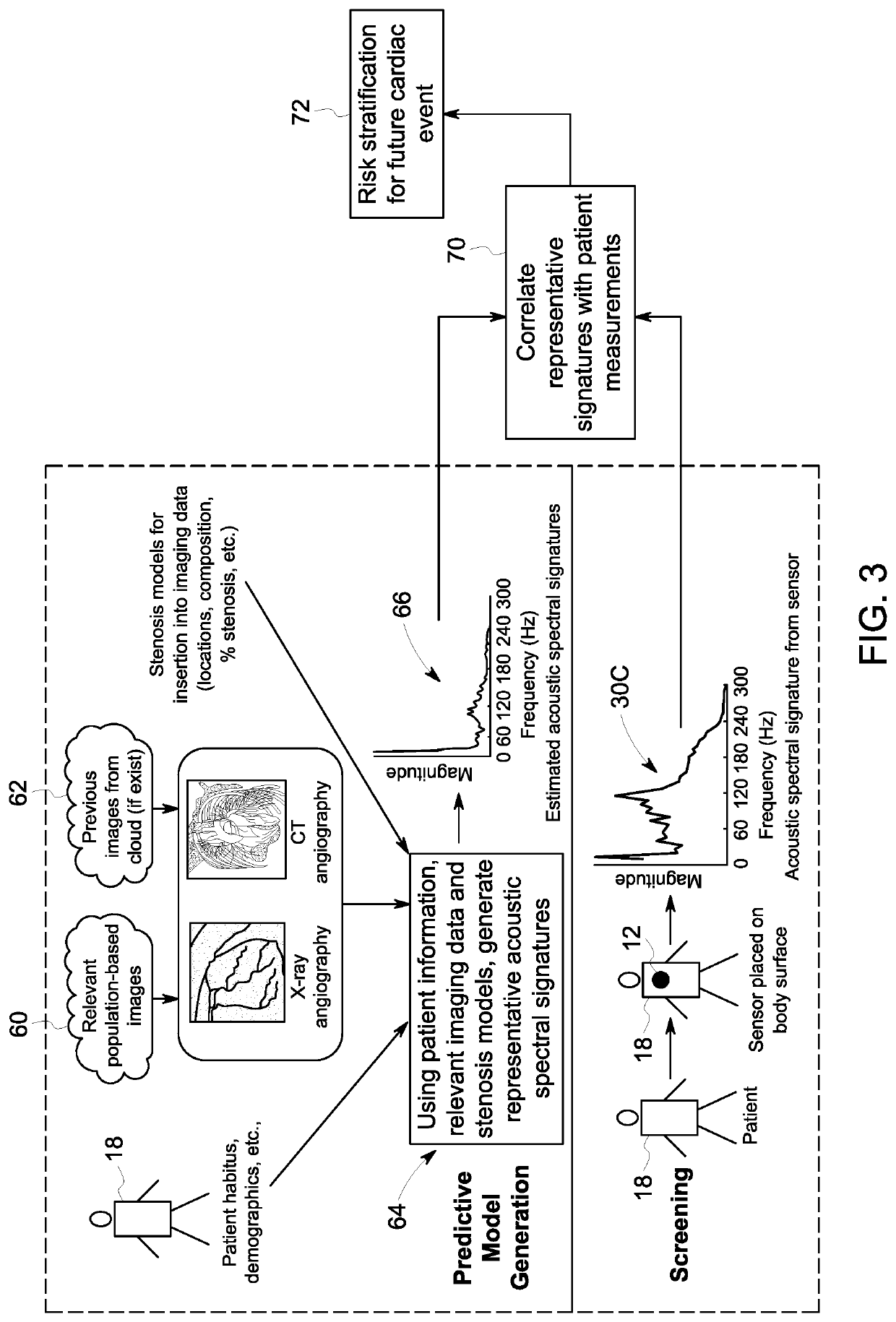 Vascular assessment using acoustic sensing