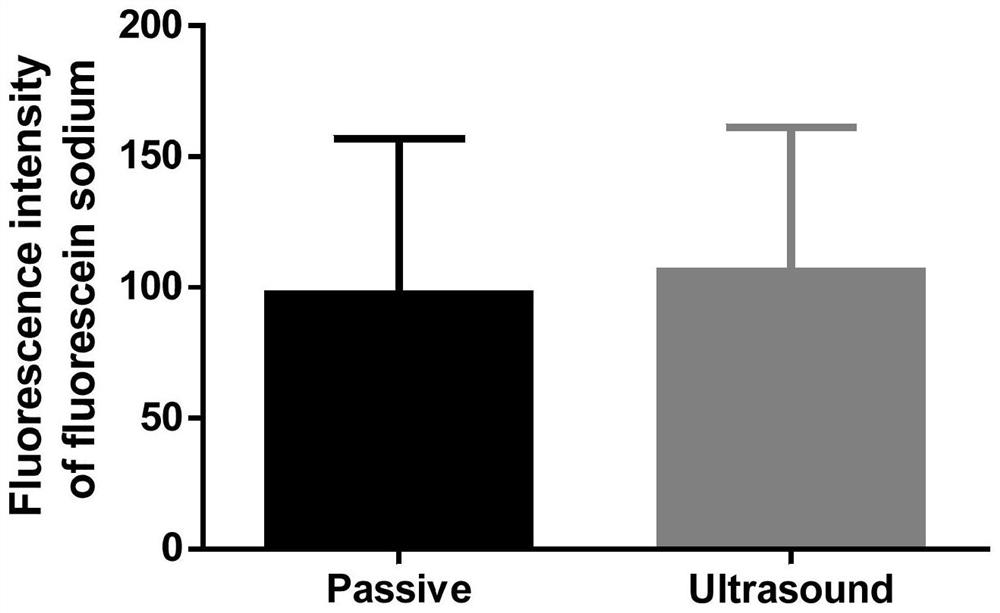 Method for regulating barrier permeability by using ultrasound