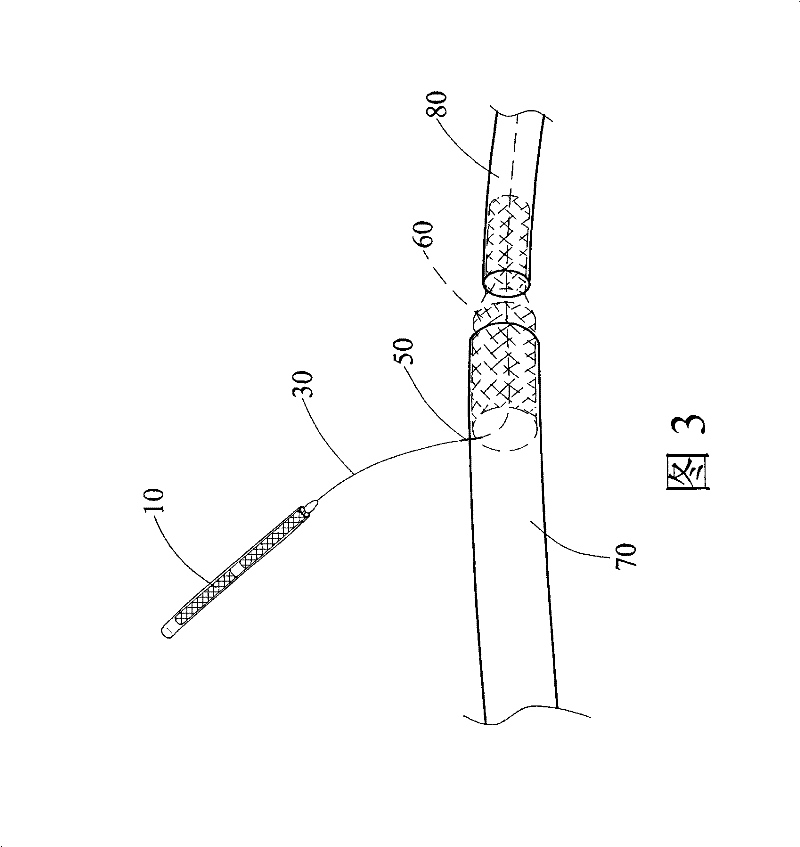 Blood vessel stent device