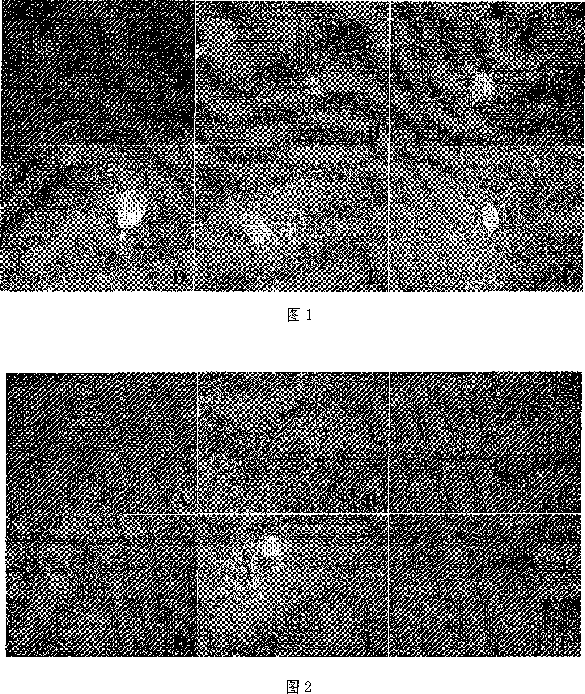 Application of Fructus Forsythiae in preparing anti-tumor chemotherapeutic sensitivity intensifying attenuating medicine