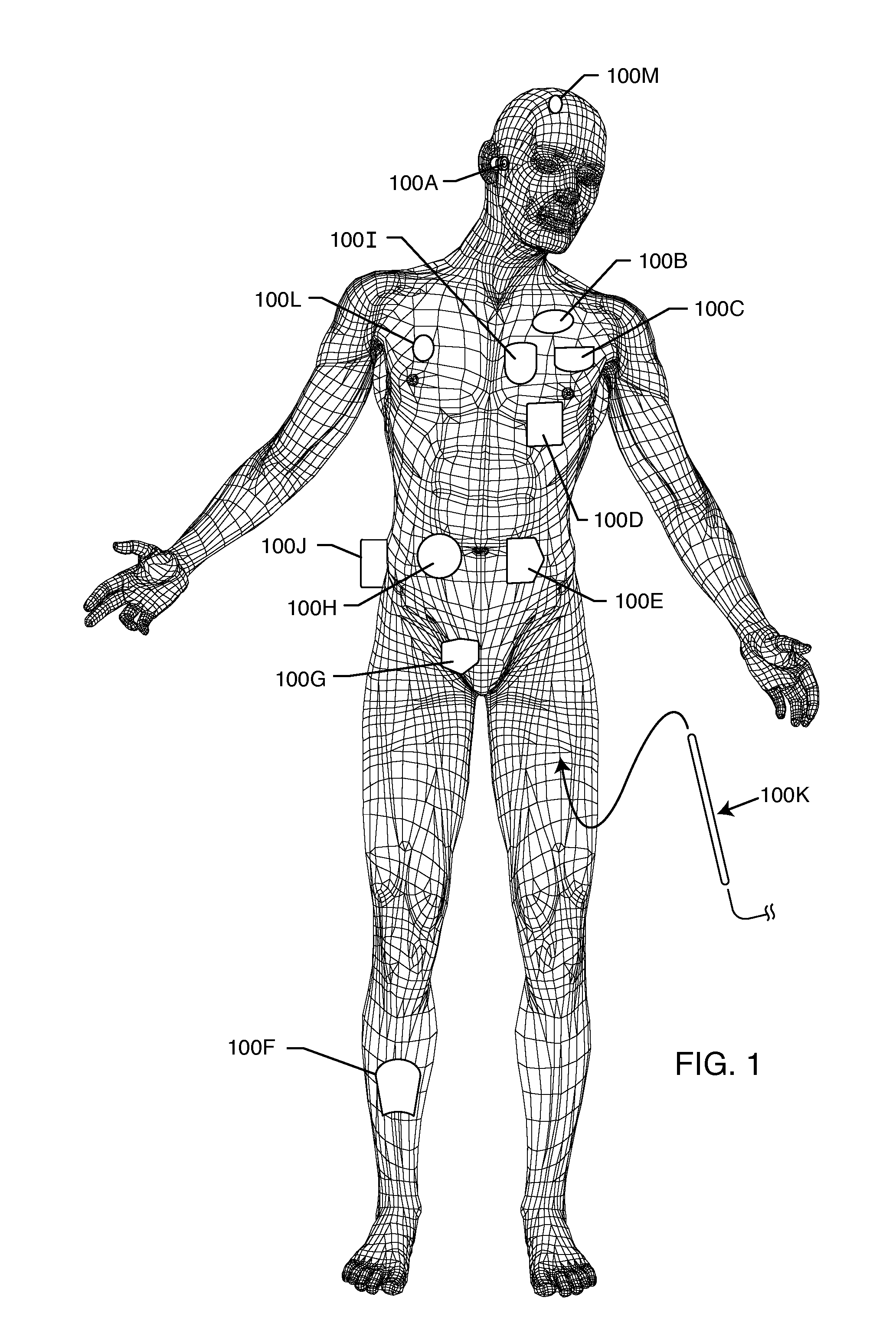 Tank filters placed in series with the lead wires or circuits of active medical devices to enhance MRI compatability