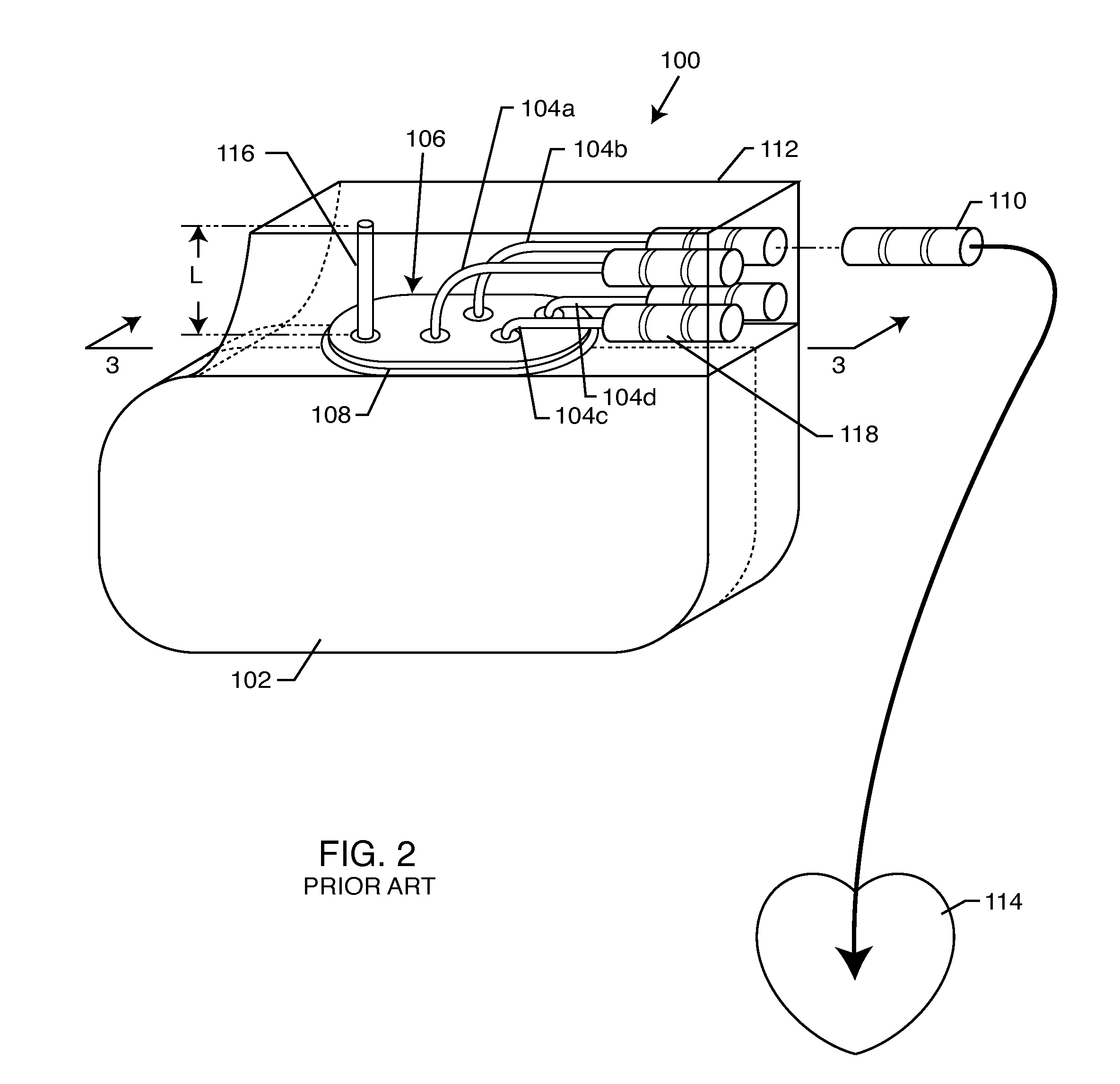 Tank filters placed in series with the lead wires or circuits of active medical devices to enhance MRI compatability