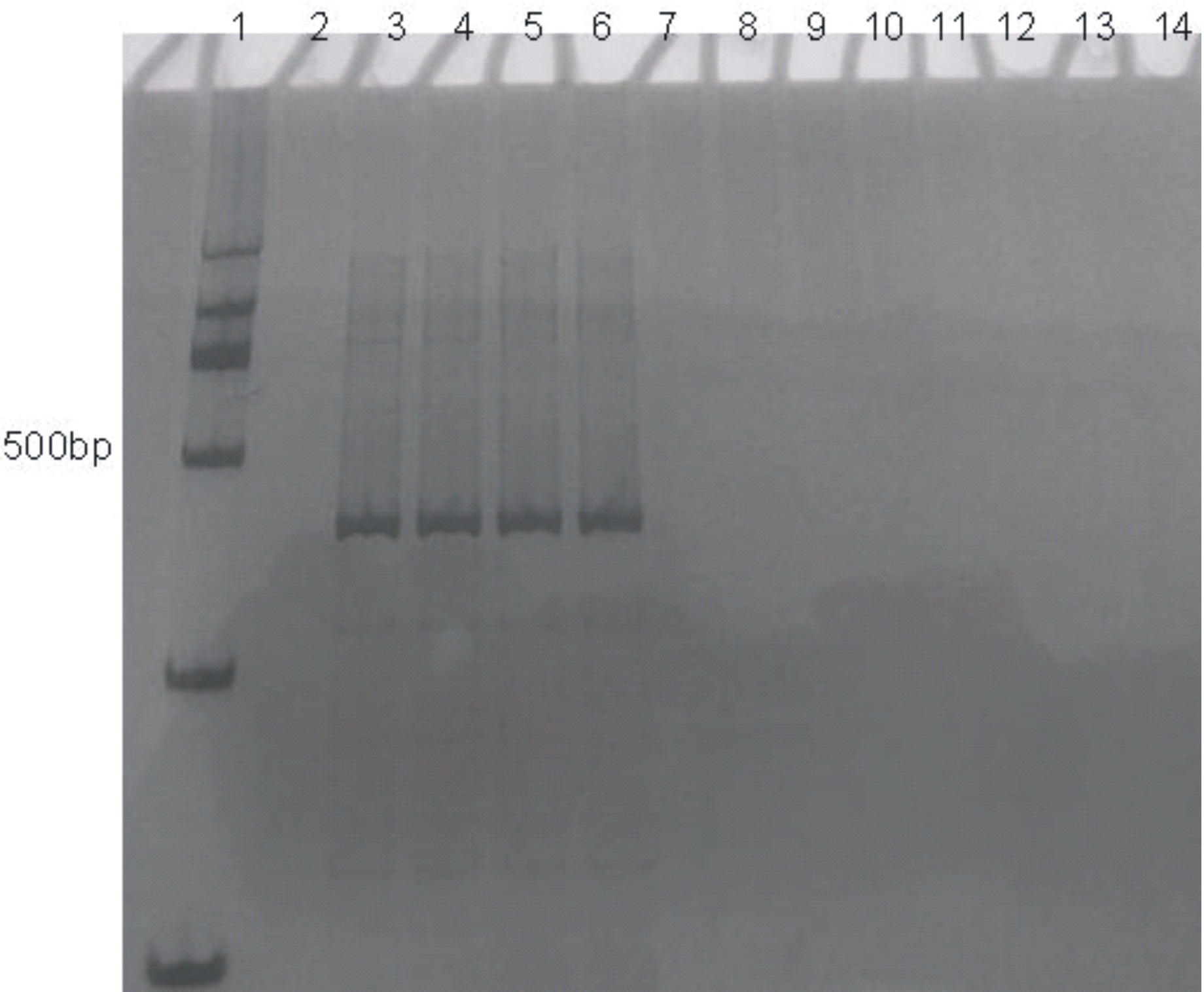 Specific amplification primer for detecting marssonina coronaria and detection method