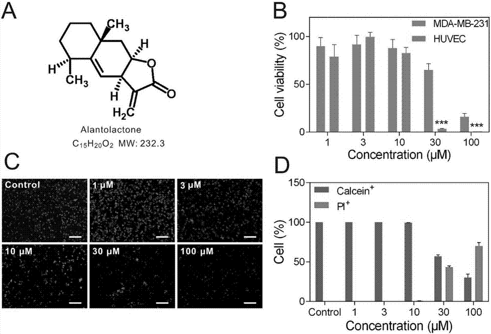 Application of alantolactone serving as anti-angiogenesis drug