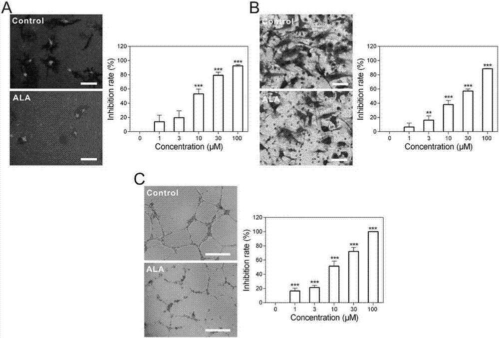 Application of alantolactone serving as anti-angiogenesis drug