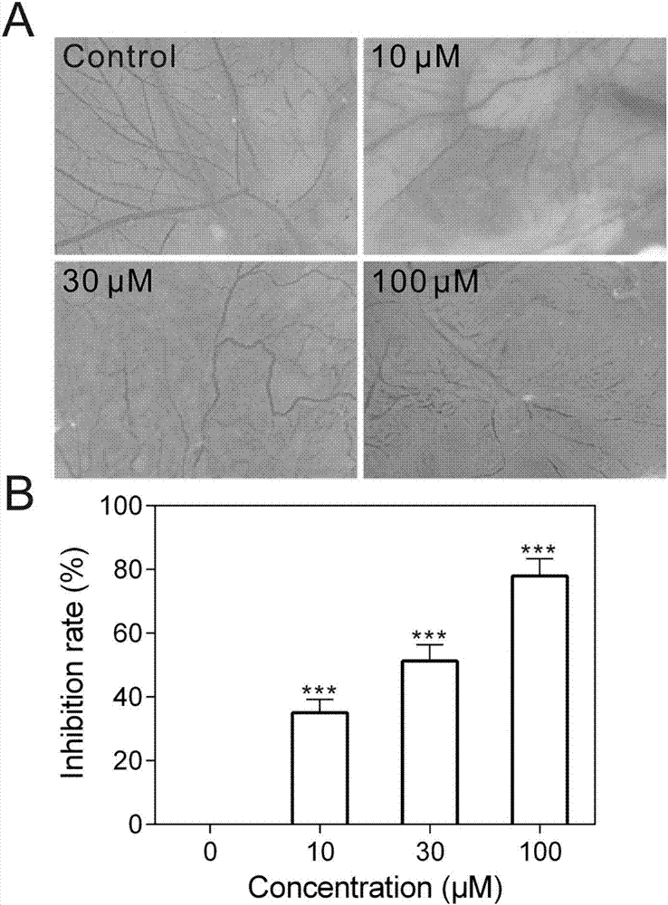 Application of alantolactone serving as anti-angiogenesis drug