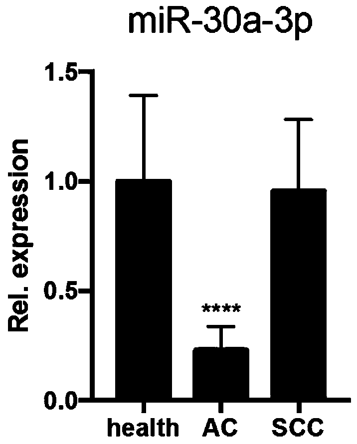 Application of exosome miRNA in preparation of lung cancer early diagnosis kit, and lung cancer early diagnosis detection kit