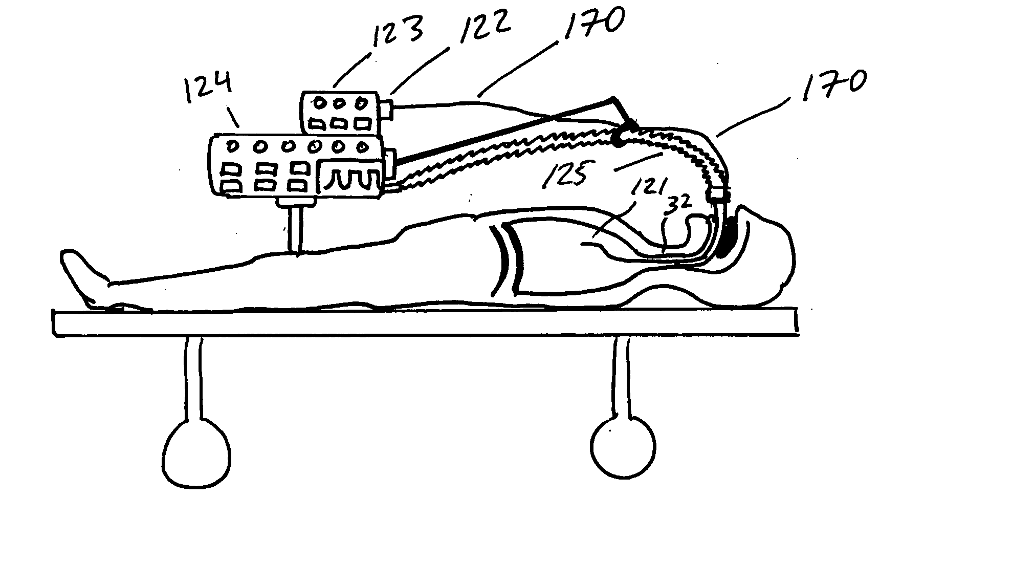 Methods, systems and devices for improving ventilation in a lung area