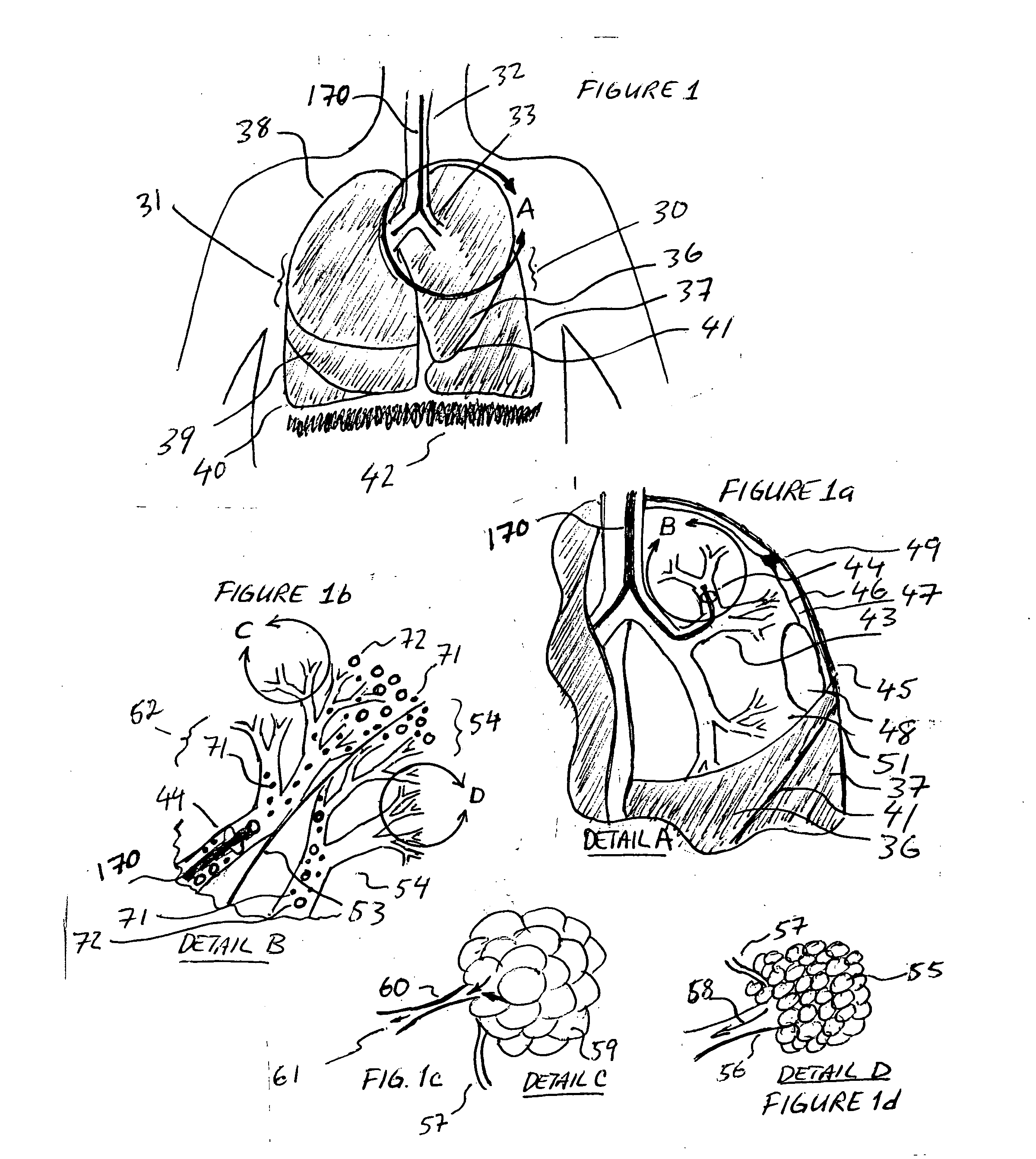 Methods, systems and devices for improving ventilation in a lung area