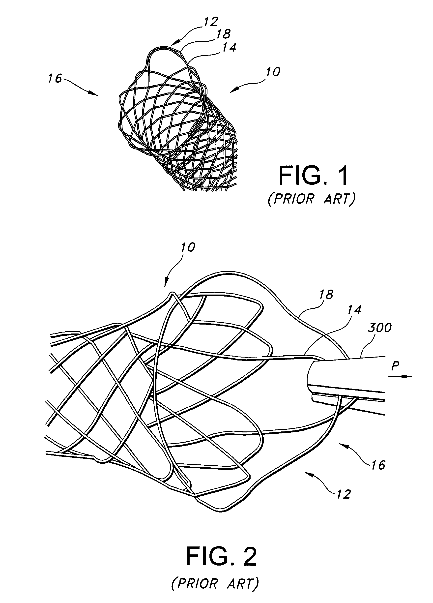 Integrated stent retrieval loop adapted for snare removal and/or optimized purse stringing