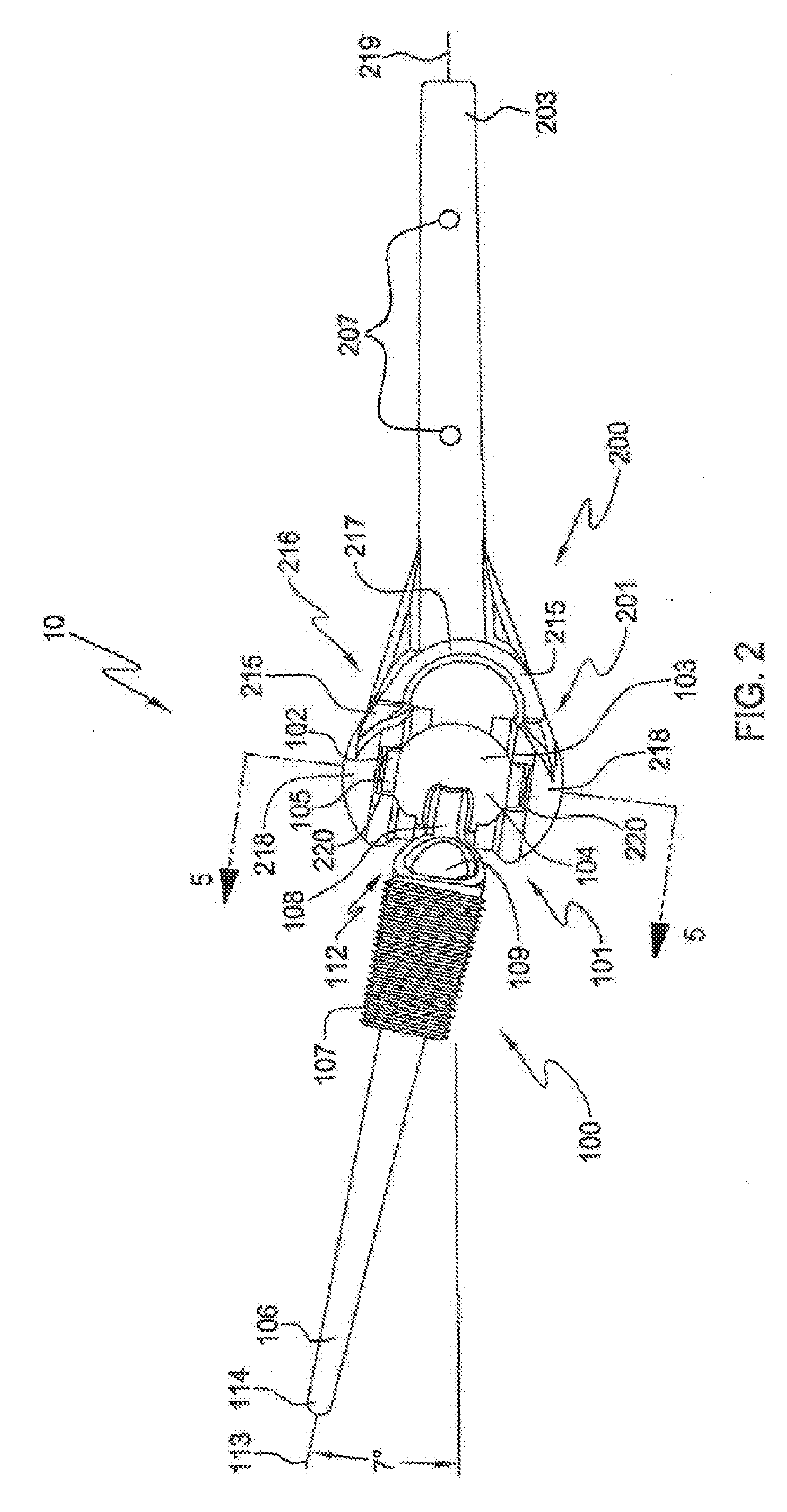 Elbow prosthesis and method of use