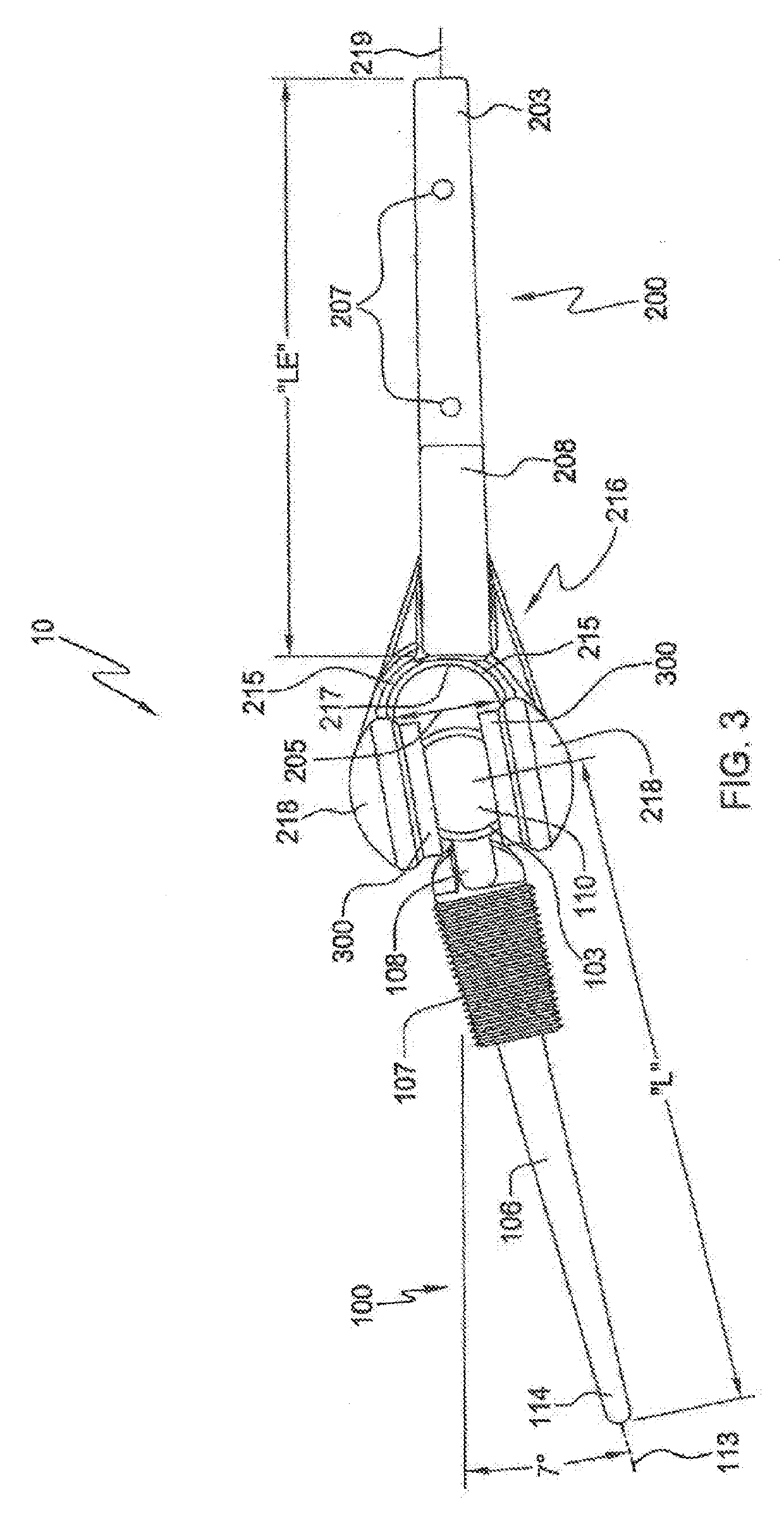 Elbow prosthesis and method of use