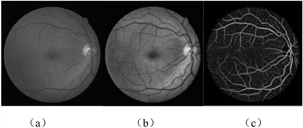 Retinal vessel segmentation method based on combination of deep learning and traditional method