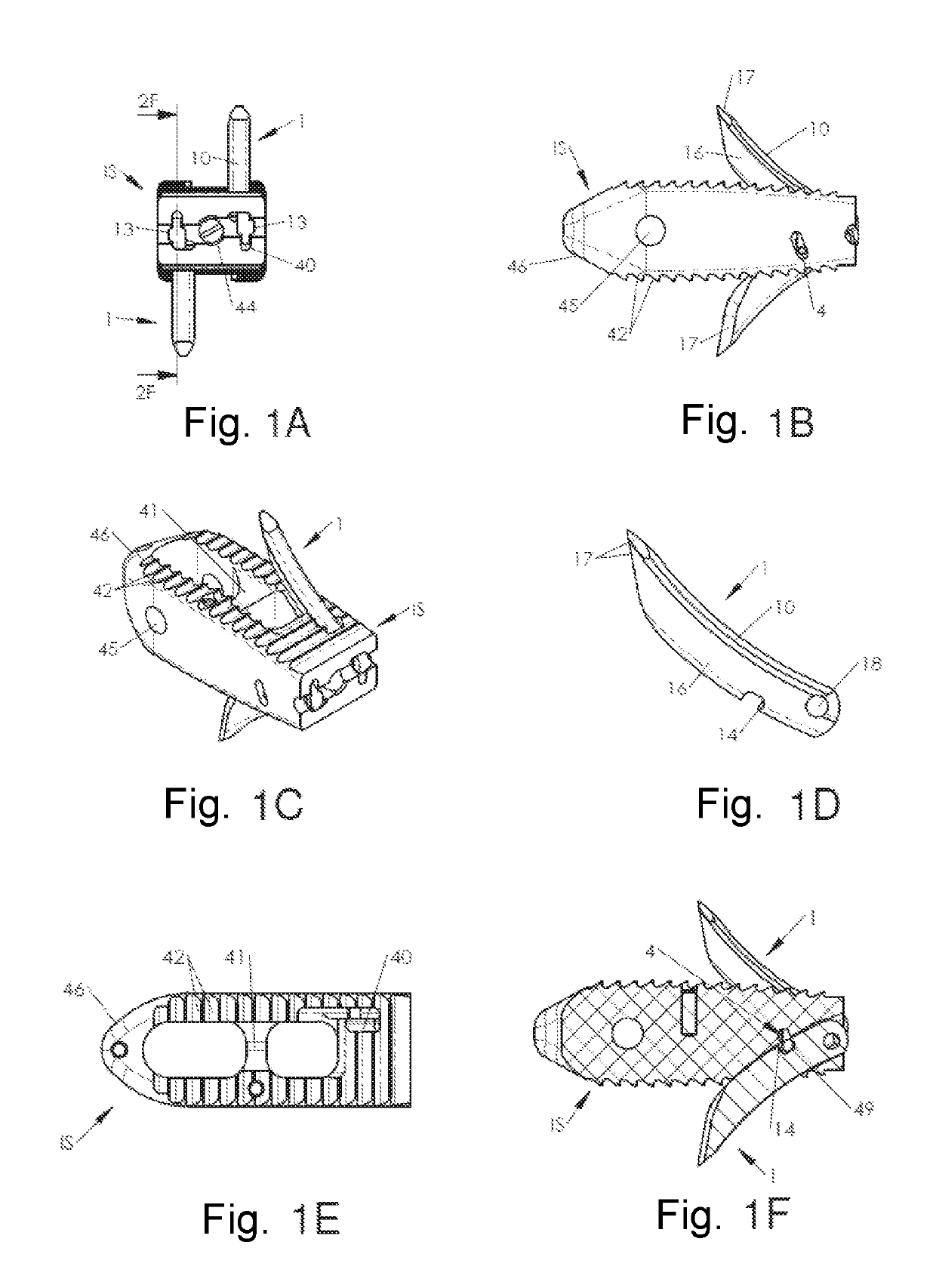 System of spinal arthodesis implants