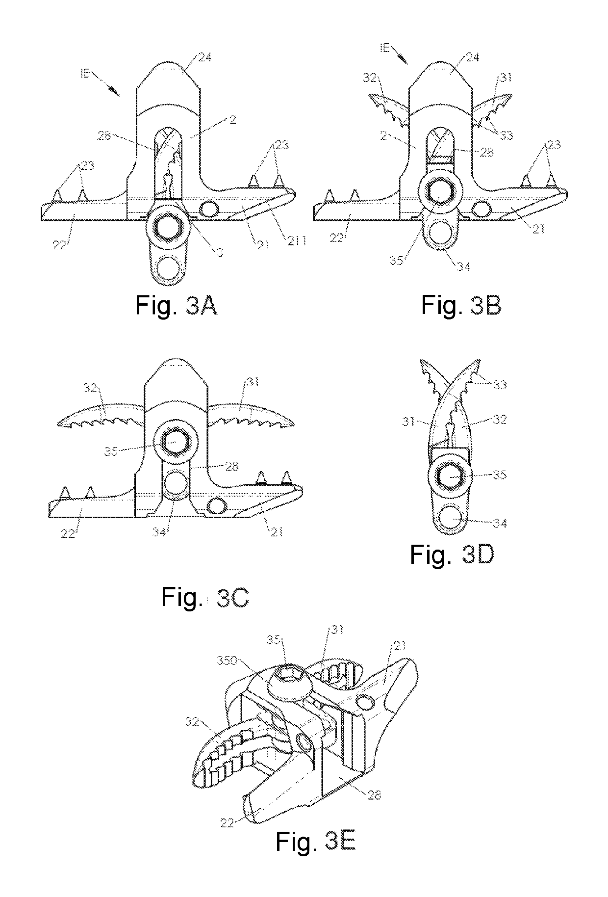 System of spinal arthodesis implants