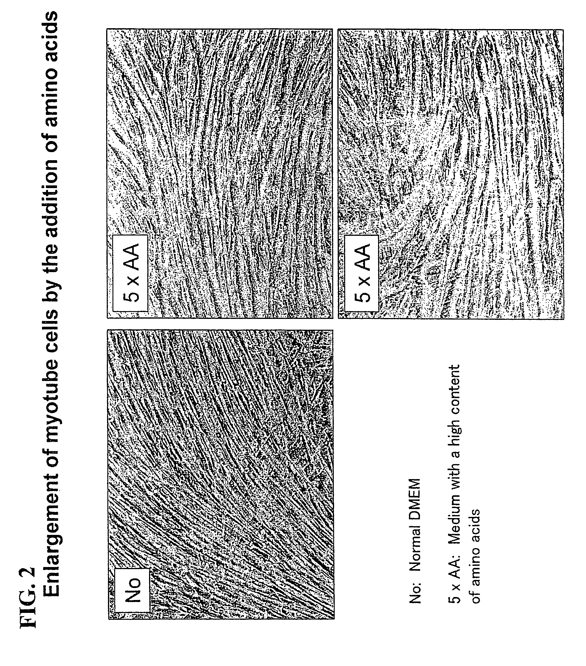 Cultured muscle cells with high metabolic activity and method for production of the cultured muscle cells