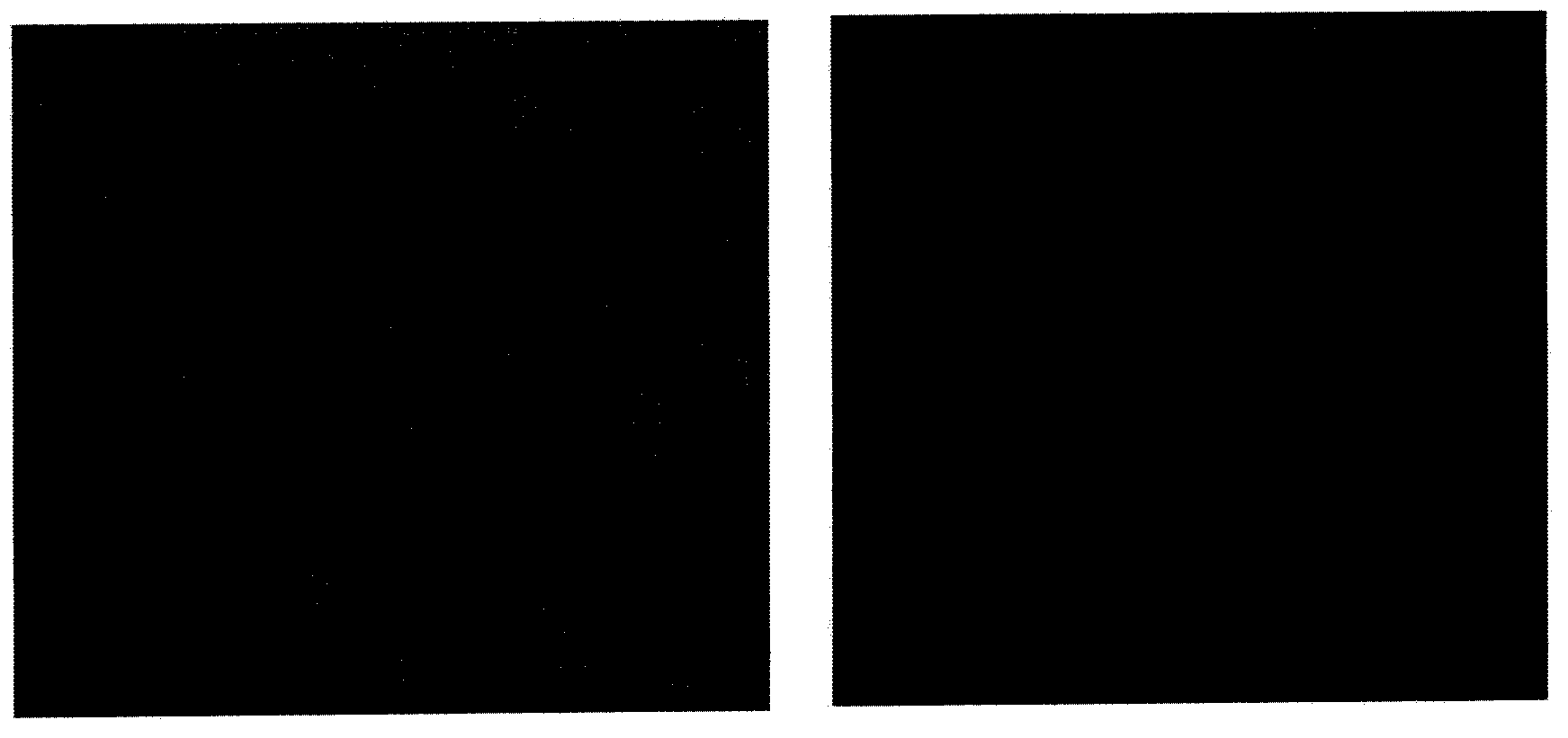 Oral and injection dual-effect protein or polypeptide drug controlled-release vesicle and preparation method thereof