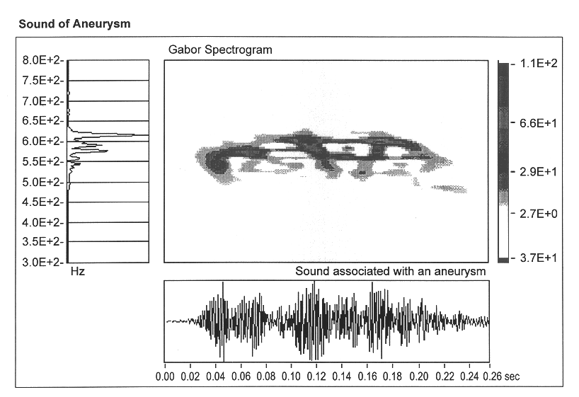 Signal analyzer system and method for computing a fast Gabor spectrogram